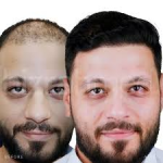zunnikhan122