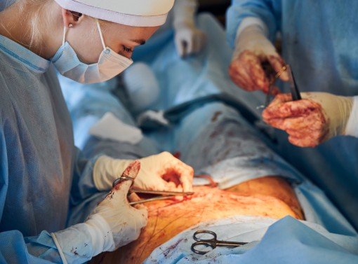 Hysterectomy Surgery in Delhi