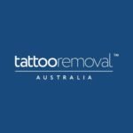 tattoo removal australia -laser tattoo removal in brisbane