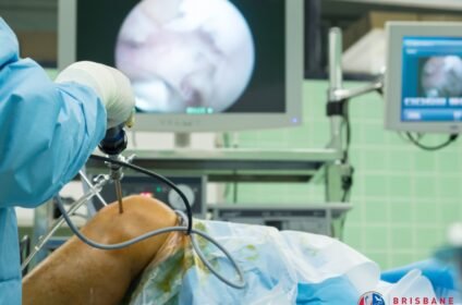 Knee-Reconstruction